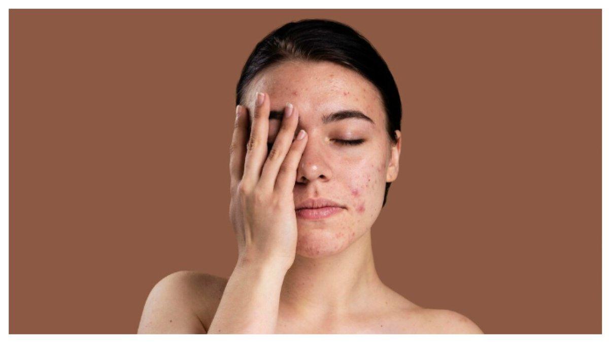 Dokter Naturopati Ungkap: Ciri-Ciri Wajah yang Menandakan Konsumsi Berlebih Gula, Gluten, dan Susu, Anggur Dokter Naturopati Ungkap: Ciri-Ciri Wajah yang Menandakan Konsumsi Berlebih Gula, Gluten, dan Susu, Anggur