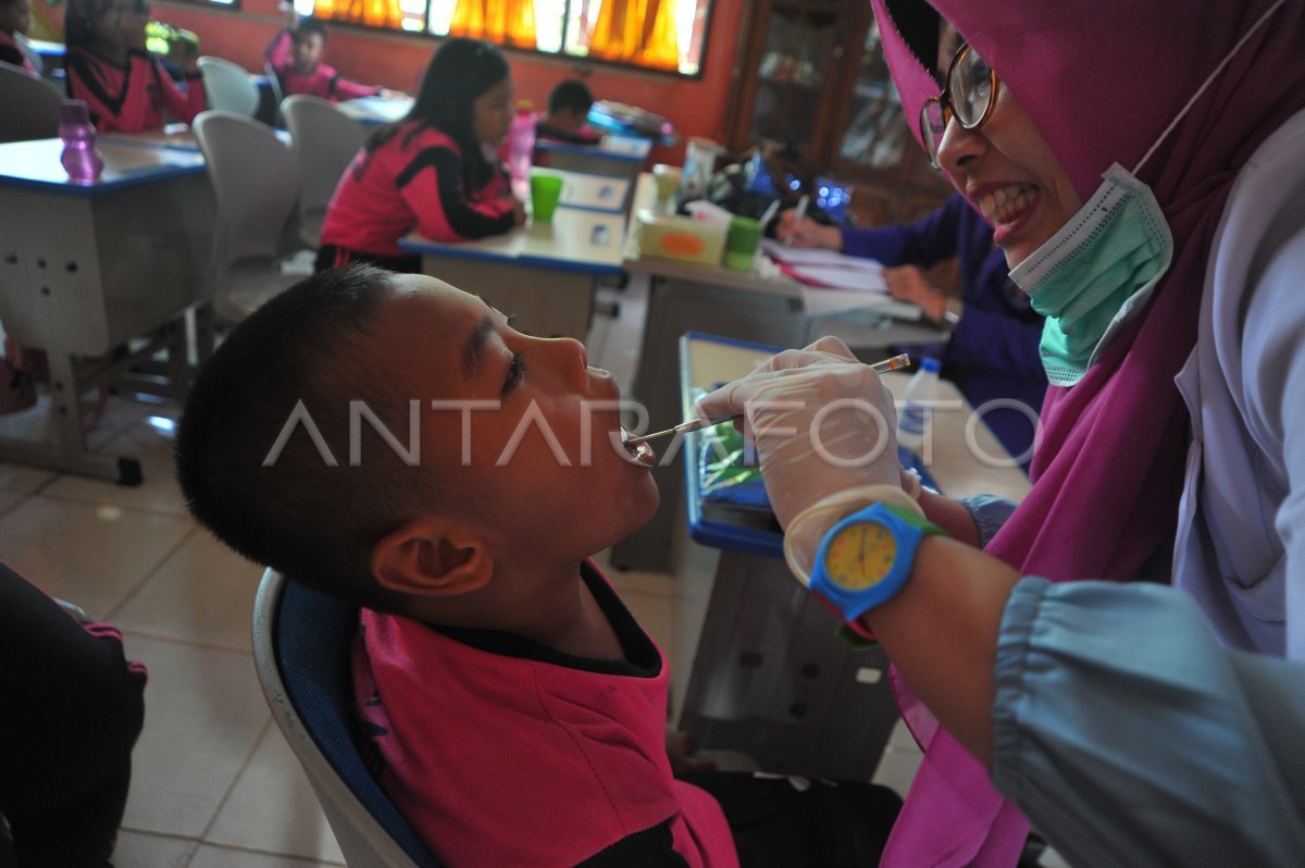 Program Kesehatan Gratis Ungkap Masalah Gigi dan Telinga Siswa di Indramayu Program Kesehatan Gratis Ungkap Masalah Gigi dan Telinga Siswa di Indramayu
